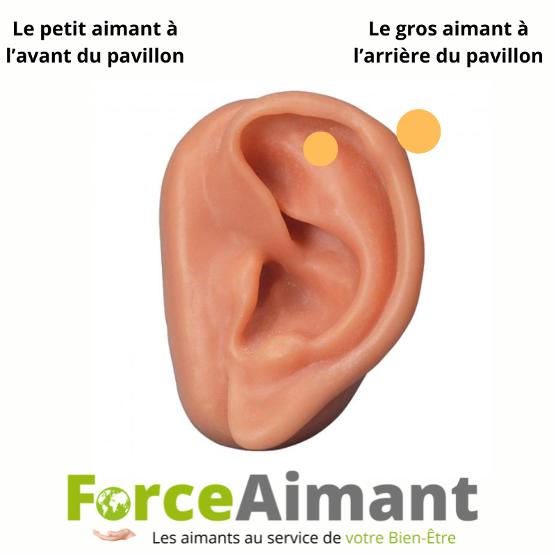 Aimants arrêt tabac à positionner sur l'oreille pour accompagner une démarche de sevrage tabagique.