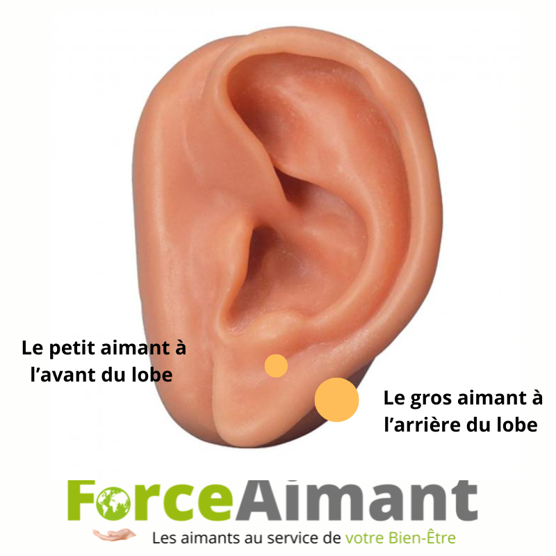 Aimants mal des transports placés sur le lobe de l'oreille pour aider à soulager les nausées