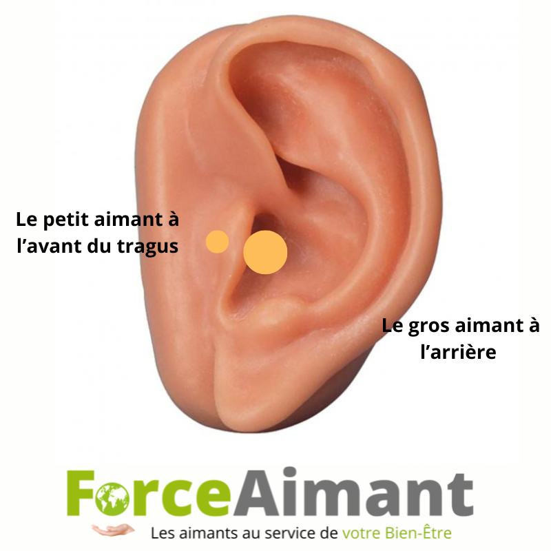 Aimants minceur à placer sur l'oreille pour accompagner une démarche de bien-être.